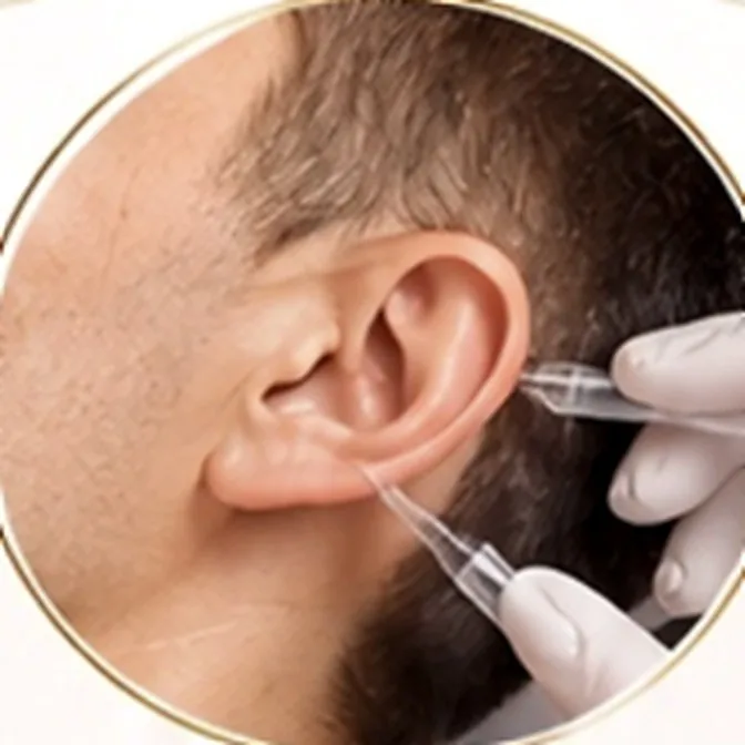 Aplicación de mesoterapia capilar en el cuero cabelludo, junto a la oreja